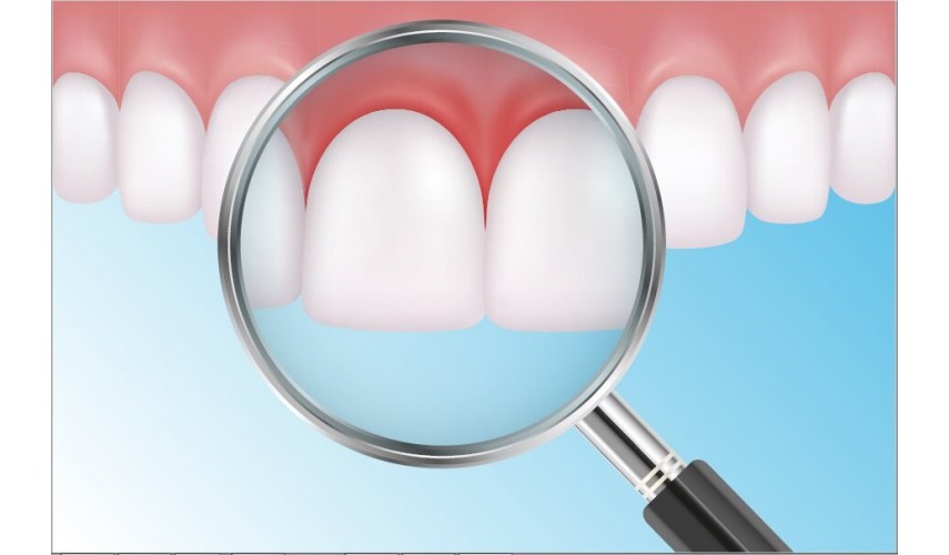 Inflamed gums, is this your case?